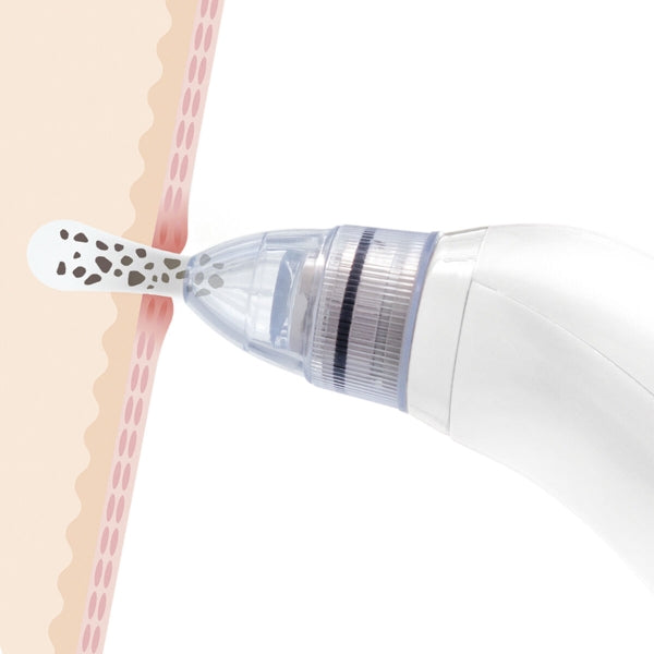 Electric Blackhead Facial Cleanser