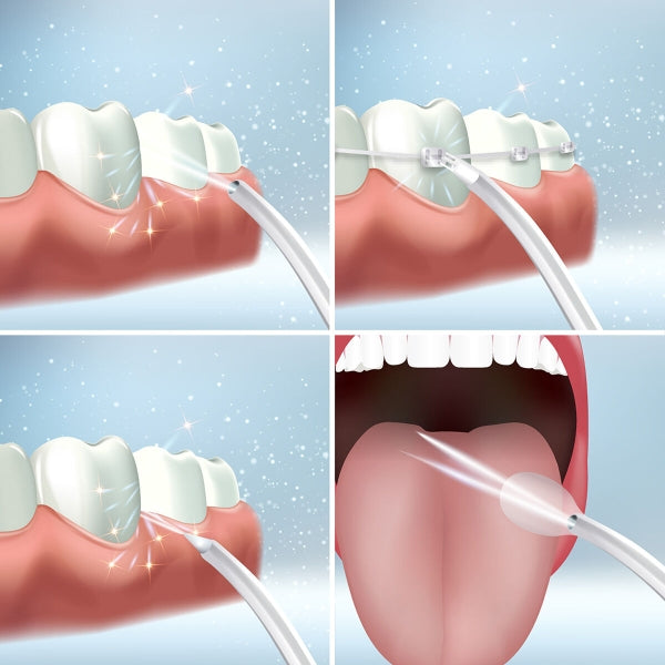 Portable Rechargeable Oral Irrigator